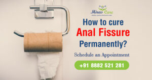 How to cure anal fissure permanently