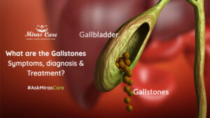 What are the gallstones- Symptoms, diagnosis & Treatment