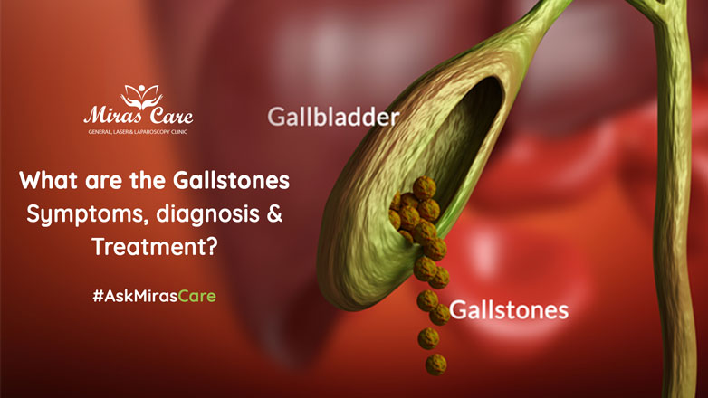 Gallstones - Causes, Symptoms- Best Gallstone Treatment Doctor in Gurgaon