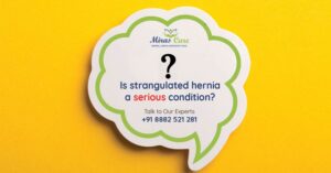 Is strangulated hernia a serious condition