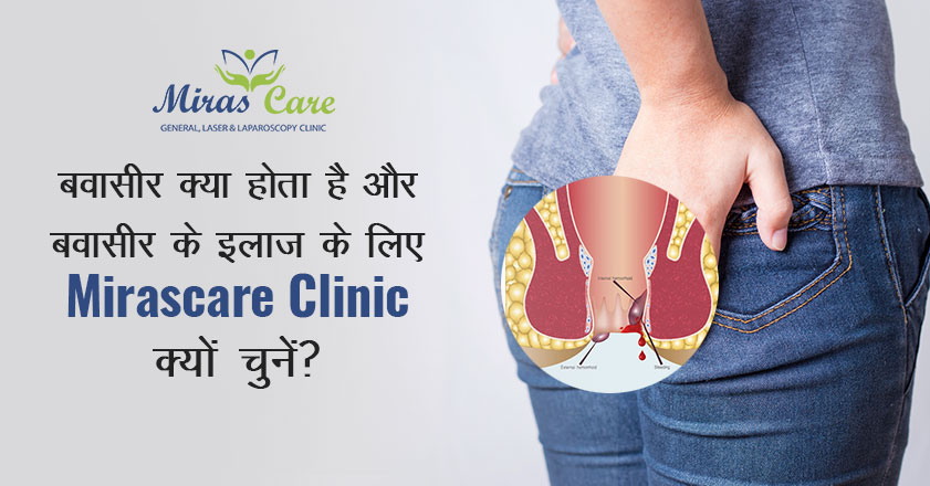 बवासीर क्या होता है?