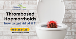 What are Thrombosed Haemorrhoids or piles