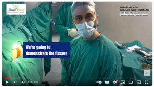 Laser Excision of Sentinel Tag with Fissure & Haemorrhoids