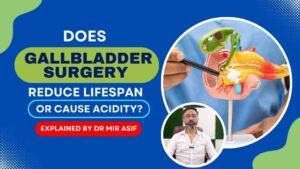 Does Gallbladder Surgery Reduce Life Span or Cause Acidity?