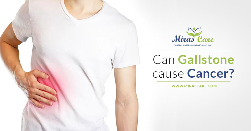 Can Gallstone cause Cancer?