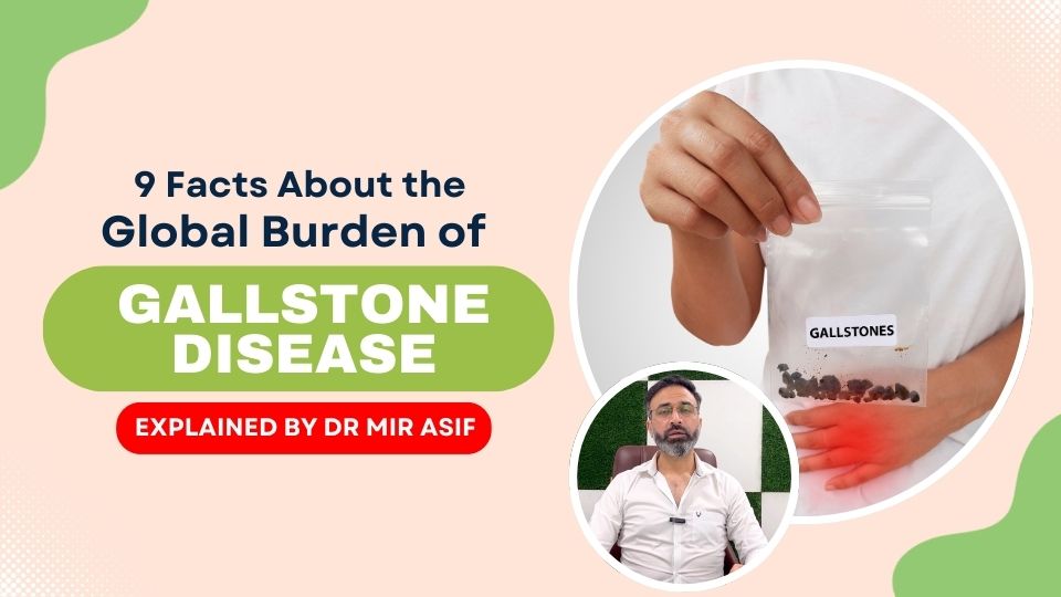9 Facts About the Global Burden of Gallstone Disease