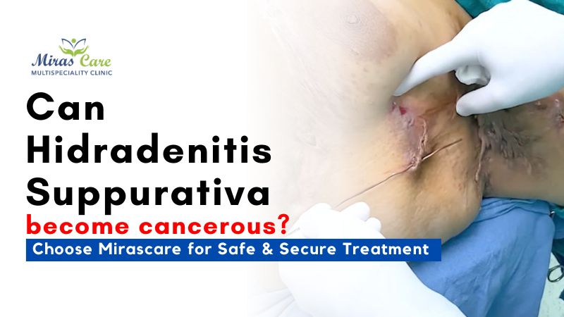 Can Hidradenitis Suppurativa (HS) become cancerous?