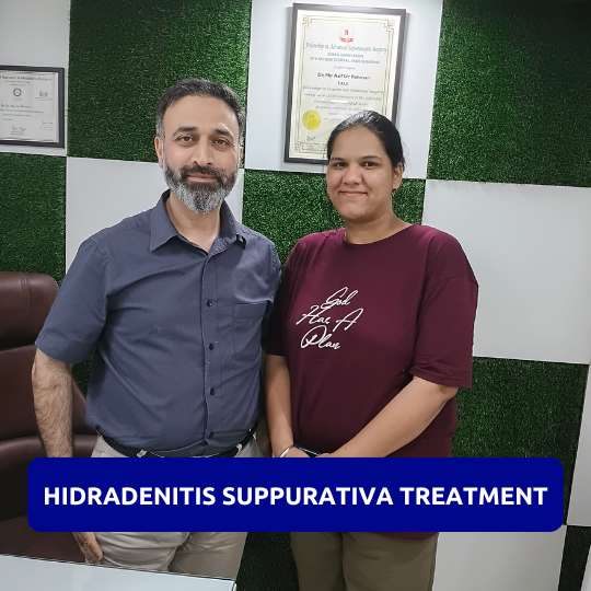 Happy Patient after Successful Hidradenitis suppurativa (HS) treatment in Gurgaon Hidradenitis suppurativa (HS) treatment patient in Gurgaon