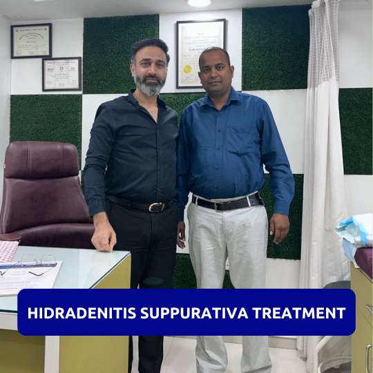 Hidradenitis suppurativa (HS) treatment patient in Gurgaon Hidradenitis suppurativa (HS) treatment patient in Gurgaon