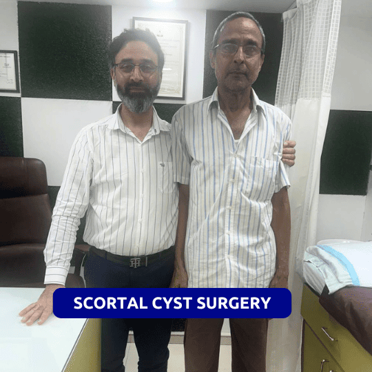 Scortal cyst surgery review