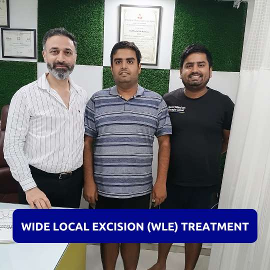 Happy Patient after Successful Wide Local Excision (WLE) Treatment in Gurgaon Wide Local Excision (WLE) treatment patient in Gurgaon