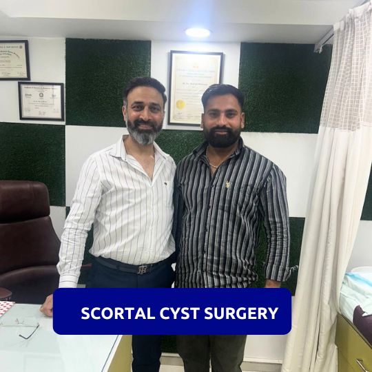 Scortal cyst surgery review